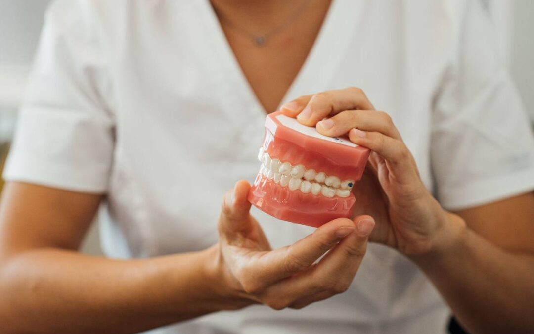How Long Do Denture Last